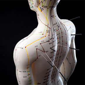 back of acupuncture model with meridians labeled and needles
