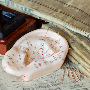acupuncture needles stuck in labeled ear model