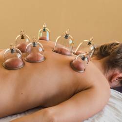 patient laying face down during cupping therapy with suction cups on their upper back