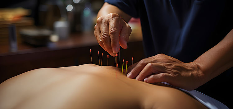 acupuncturist does needle session on florida client